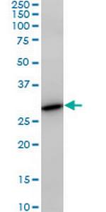 PAFAH1B3 Antibody in Western Blot (WB)