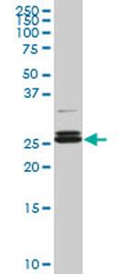 PAFAH1B3 Antibody in Western Blot (WB)