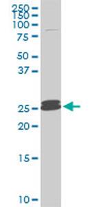 PAFAH1B3 Antibody in Western Blot (WB)