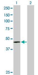 PAH Antibody in Western Blot (WB)