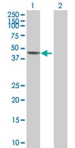 SERPINE1 Antibody in Western Blot (WB)