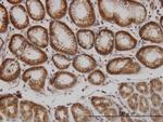 PAK1 Antibody in Immunohistochemistry (Paraffin) (IHC (P))