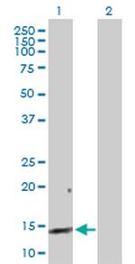 REG3A Antibody in Western Blot (WB)