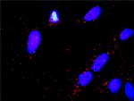 PARK2 Antibody in Proximity Ligation Assay (PLA) (PLA)