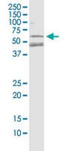 PARK2 Antibody in Western Blot (WB)