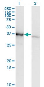 PCBP1 Antibody in Western Blot (WB)