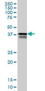 PCBP2 Antibody in Western Blot (WB)