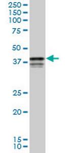 PCBP2 Antibody in Western Blot (WB)