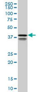 PCBP2 Antibody in Western Blot (WB)