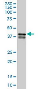 PCBP2 Antibody in Western Blot (WB)