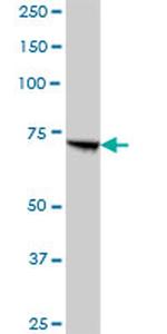 PCCA Antibody in Western Blot (WB)