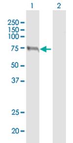 PCCA Antibody in Western Blot (WB)