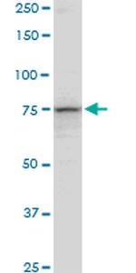 PCCA Antibody in Western Blot (WB)