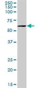 PCCB Antibody in Western Blot (WB)