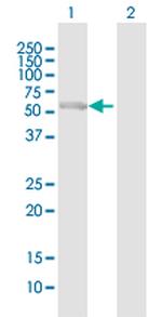 PCCB Antibody in Western Blot (WB)