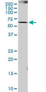 PCCB Antibody in Western Blot (WB)