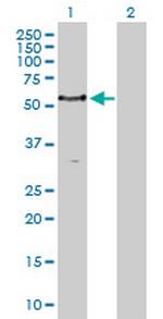 PCTK1 Antibody in Western Blot (WB)