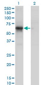 PCTK1 Antibody in Western Blot (WB)