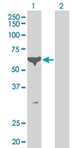 PCTK1 Antibody in Western Blot (WB)