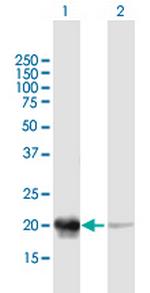 PDC Antibody in Western Blot (WB)