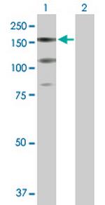 PDGFRA Antibody in Western Blot (WB)