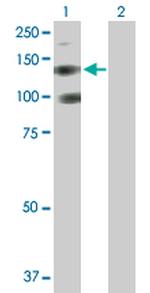 PDGFRA Antibody in Western Blot (WB)