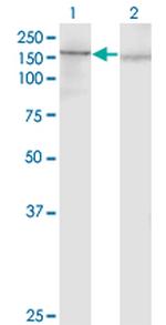 PDGFRA Antibody in Western Blot (WB)