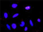 PDGFRB Antibody in Proximity Ligation Assay (PLA) (PLA)