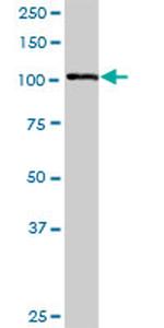 PDGFRB Antibody in Western Blot (WB)