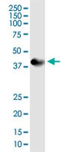 PDHA1 Antibody in Western Blot (WB)