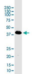 PDHA1 Antibody in Western Blot (WB)