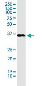 PDHA1 Antibody in Western Blot (WB)