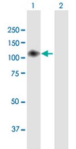 ENPP2 Antibody in Western Blot (WB)