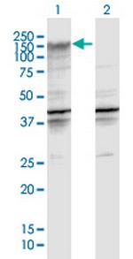 ENPP2 Antibody in Western Blot (WB)