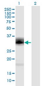 PENK Antibody in Western Blot (WB)