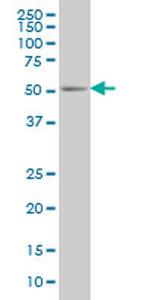 PEPD Antibody in Western Blot (WB)