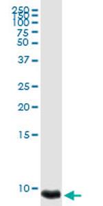 PF4 Antibody in Western Blot (WB)