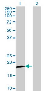 PFDN2 Antibody in Western Blot (WB)