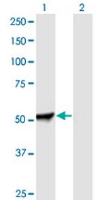 PFKFB2 Antibody in Western Blot (WB)