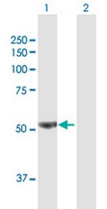 PFKFB3 Antibody in Western Blot (WB)