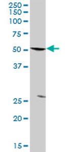 PFKFB3 Antibody in Western Blot (WB)