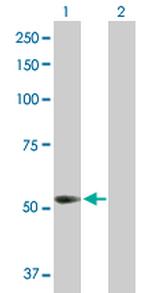 PFKFB3 Antibody in Western Blot (WB)