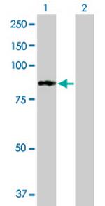 PFKL Antibody in Western Blot (WB)