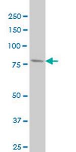 PFKL Antibody in Western Blot (WB)