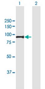 PFKM Antibody in Western Blot (WB)