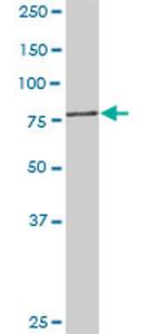 PFKM Antibody in Western Blot (WB)