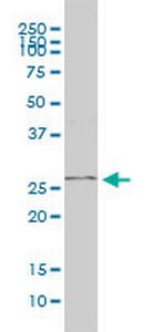 PGAM1 Antibody in Western Blot (WB)