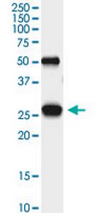 PGAM1 Antibody in Immunoprecipitation (IP)