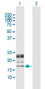 PGF Antibody in Western Blot (WB)