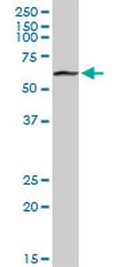 PGM1 Antibody in Western Blot (WB)